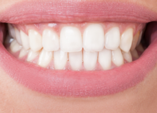 Zähne und Lächeln Zähne und Lächeln